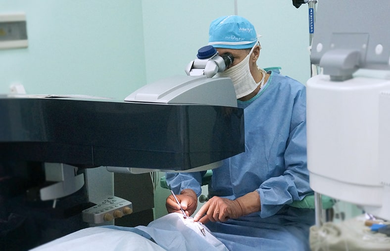 Для лазерной коррекции астигматизма на основном этапе операции мы используем эксимерный лазер