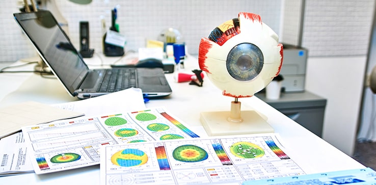 Лазерная трабекулопластика является значимым методом в лечении глаукомы. 