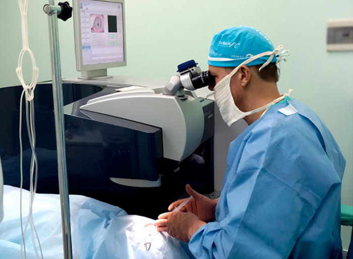 лазерная коррекция цены