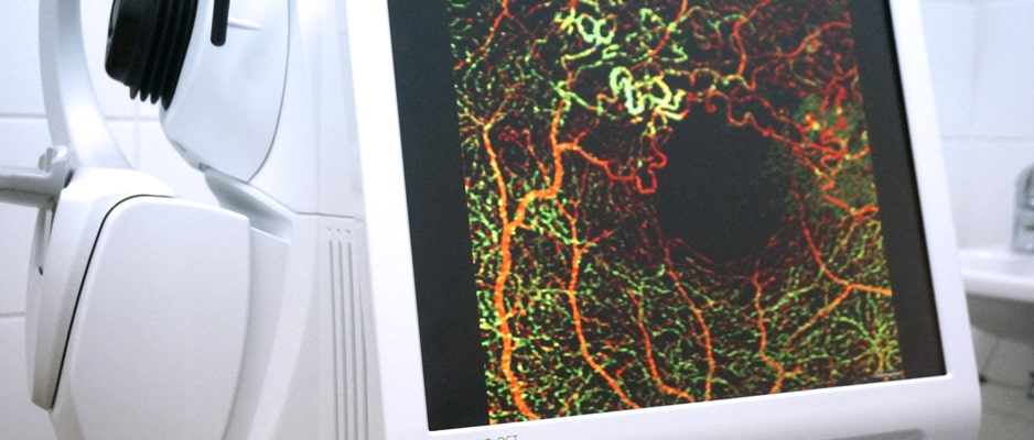 Заболевания сетчатки, способствующие сильному снижению зрения и встречающиеся наиболее часто, – это макулярная дегенерация, диабетическая ретинопатия, периферическая дегенерация сетчатки zabolevaniya_setchatki.jpg
