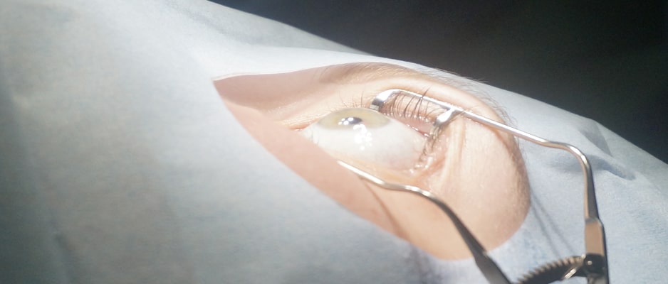 Супер Лазик