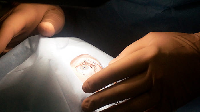 лазерная коррекция зрения: стоимость в Москве лазерная коррекция зрения: стоимость в Москве