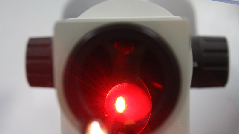 metodika-selektivnoj-lazernoj-trabekuloplastiki1.jpg metodika-selektivnoj-lazernoj-trabekuloplastiki1.jpg