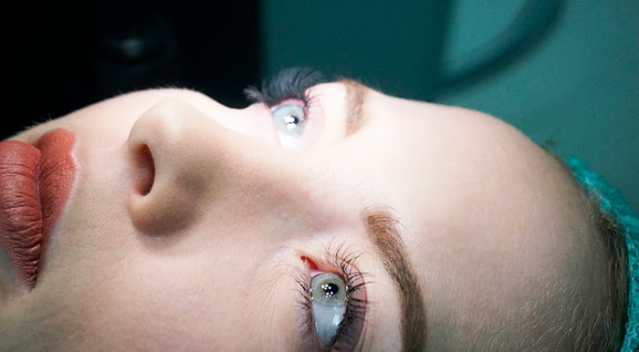 операция супер ласик