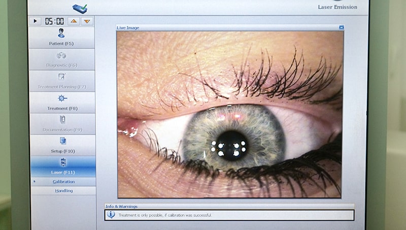 Метод может применяться у пациентов с тонкой роговицей.