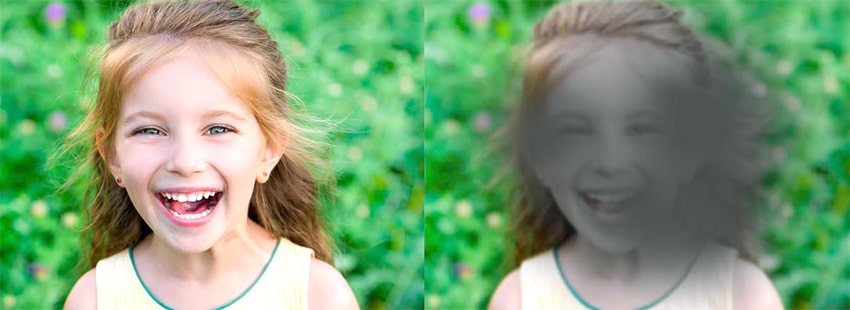 Появление темного пятна в поле зрения Дегенерация макулы