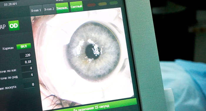 Ласик – последствия минимальны