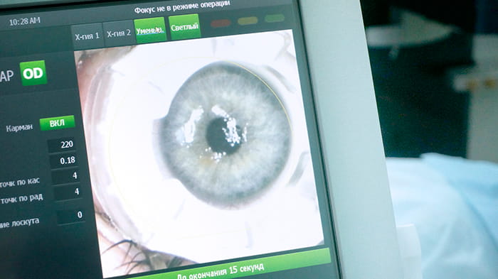 лучший из методов лечения дальнозоркости – лазерная операция