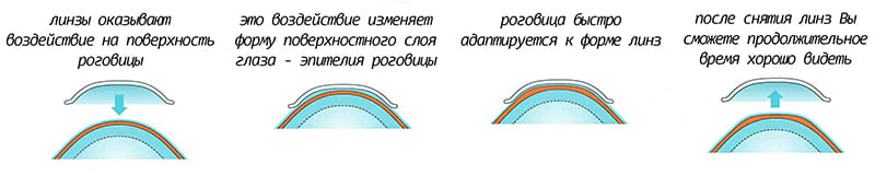 астигматизм