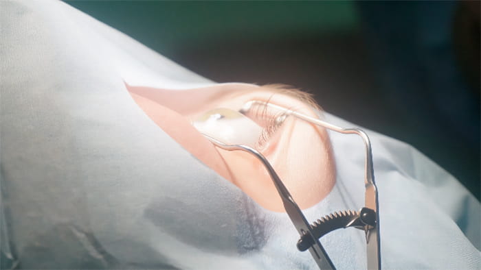 операция Лазик: цена теперь более доступна операция Лазик: цена теперь более доступна