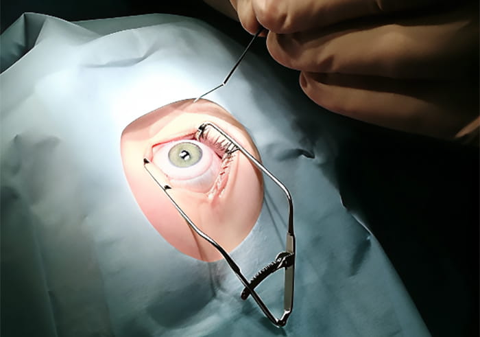 на лазерную коррекцию зрения цены доступны