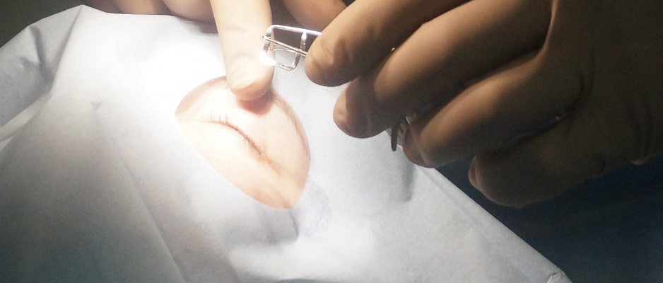 В ходе лазерной коррекции зрения методом Ласик в Москве используется специализированный прибор, который называется микрокератом lasik_moskva.jpg