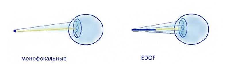 монофокальный – EDOF