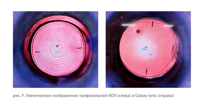 RayOne Galaxy_1.jpg